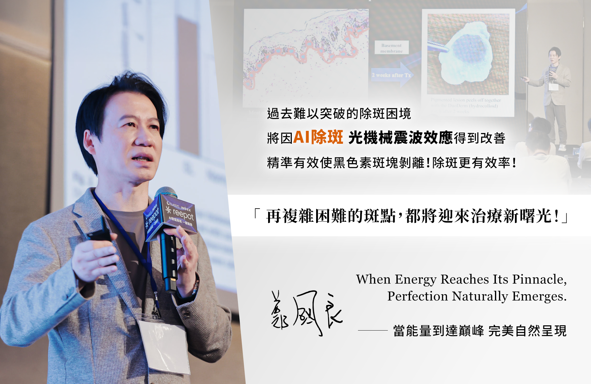 除斑雷射治療迎來新曙光！